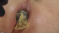 inserção completa do plugue traseiro do preservativo