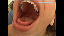 Girl Throat Gagging Vomit Kotzen Erbrechen und Barf