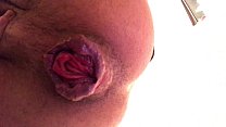 22yo Rosebud Prolapse Cu Arrombado Wrecked Hole Anal Pig Extreme Hardcore Fetish