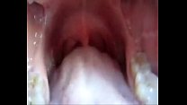 L'interno della bocca