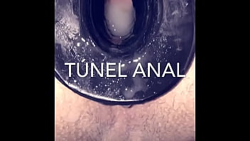 Tunel anal