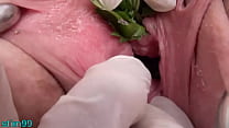 ja Nettles in Peehole Urethral Insertion Nettles & Fisting Cunt