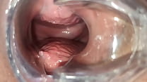 Masturbation with womb view and medical speculum, close up of my pussy